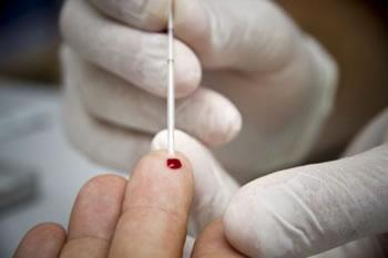 test de VIH/sida